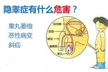 隐睾症有什么常见症