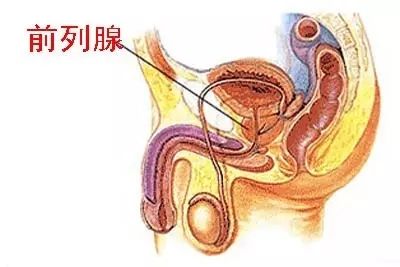 男性前列腺增大会带